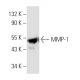MMP-1 Antibody (3B6) - Western Blotting - Image 3843