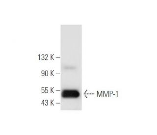MMP-1 Antibody (SB12e) - Western Blotting - Image 67834 