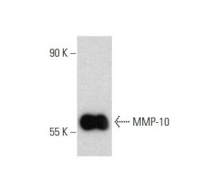 MMP-10 Antibody (LA-12) - Western Blotting - Image 144633SAM Transcription Activation: SAM system utilizing dCas9-VP64, MS2-P65-HSF1, and sgRNA for precise gene transcription activation.