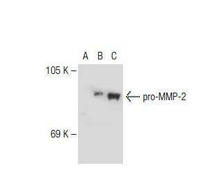 MMP2 Antibody (2C1) - Western Blotting - Image 109916 
