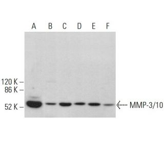 MMP-3/10 Antibody (F-10) - Western Blotting - Image 378780
