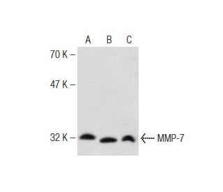 MMP-7 Antibody (JL07) - Western Blotting - Image 147324