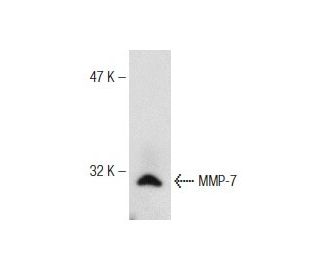 MMP-7 Antibody (MM0022-4C21) - Western Blotting - Image 147325 