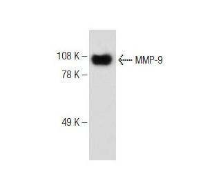 MMP9 Antibody (2C3) - Western Blotting - Image 148927 