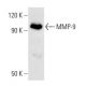 MMP9 Antibody (6-6B) - Western Blotting - Image 3855 