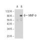 MMP9 Antibody (6-6B) - Western Blotting - Image 55004 