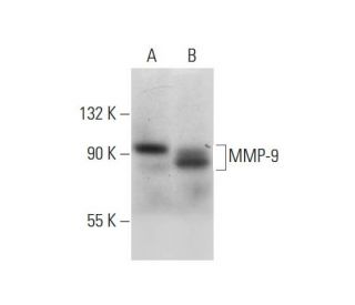 MMP9 Antibody (E-11) - Western Blotting - Image 299172The Double Nickase Plasmid features a U6 promoter for sgRNA expression, a 20 nt targeting sequence, and a gRNA scaffold to guide Cas9n. It includes a CBh promoter for Cas9n (D10A) and puromycin resistance, GFP for transfection verification, and nuclear localization signals (NLS). The 2A peptide allows co-expression of Cas9n and Puro from a single promoter, enabling precise genome editing with reduced off-target effects.