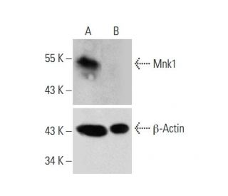 Mnk1 HDR Plasmid (h): sc-402417-HDR. Western blot analysis of Mnk1 expression in non-transfected control (A) and puromycinEach CRISPR/Cas9 Knockout (KO) Plasmid product consists of a pool of 3 plasmids designed to ensure identification and cleavage of a specific gene for maximum knockout efficiency. Each plasmid encodes a unique 20 nt sequence derived from the GeCKO (v2) library.