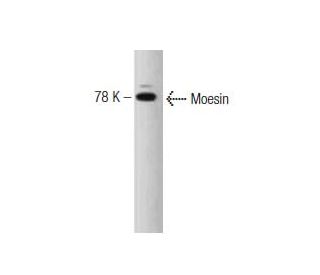 Moesin Antibody (38) - Western Blotting - Image 127503