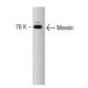 Moesin Antibody (38) - Western Blotting - Image 127503
