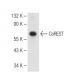 MOLT-4 nuclear extract: sc-2151. Western blot analysis of CoREST expression...
