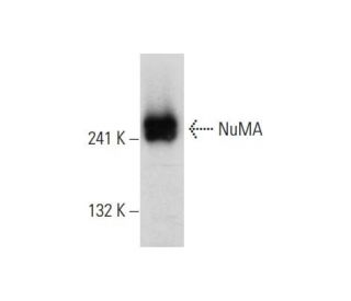 MOLT-4 nuclear extract: sc-2151. Western blot analysis of NuMA expression... 