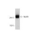 MOLT-4 nuclear extract: sc-2151. Western blot analysis of NuMA expression... 