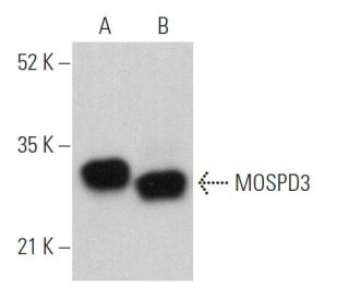 MOSPD3 Antibody (C-6) - Western Blotting - Image 368973 