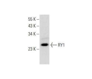 mouse heart extract: sc-2254. Western blot analysis of RY1 expression... 