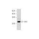 mouse heart extract: sc-2254. Western blot analysis of RY1 expression... 