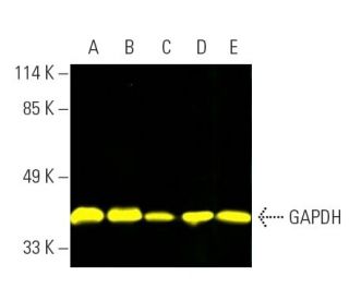 GAPDH (0411): sc-47724. Fluorescent western blot analysis of GAPDH expression in C32 (A), Jurkat (B), Hep G2 (C), BJAB (D) 