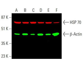 Simultaneous near-infrared western blot analysis of &beta;-Actin expression, detected with &beta;-Actin (C4): sc-47778 and m-IgG&kappa; BP 