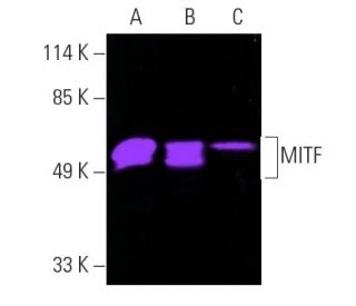 MITF (D-9): sc-515925. Fluorescent western blot analysis of MITF expression in C32 (A) and SK-MEL-28 (B) nuclear extracts 