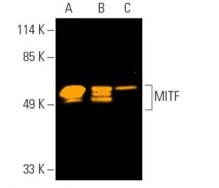 MITF (D-9): sc-515925. Fluorescent western blot analysis of MITF expression in C32 (A) and SK-MEL-28 (B) nuclear extracts 
