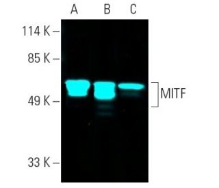 MITF (D-9): sc-515925. Fluorescent western blot analysis of MITF expression in C32 (A) and SK-MEL-28 (B) nuclear extracts 