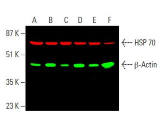 Simultaneous near-infrared western blot analysis of &beta;-Actin expression, detected with &beta;-Actin (C4): sc-47778 and m-IgG&kappa; BP 