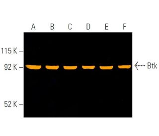 Btk (7F12H4): sc-81159. Fluorescent western blot analysis of Btk expression in Jurkat (A), MCF7 (B), K-562 (C), U-698-M (D 