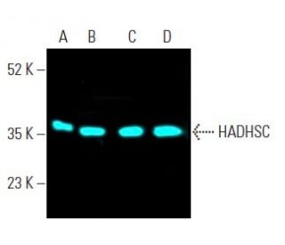 HADHSC (A-5): sc-376525. Fluorescent western blot analysis of HADHSC expression in MCF7 (A), HEK293 (B), Hep G2 (C) and c4 