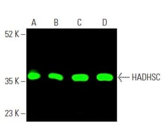 HADHSC (A-5): sc-376525. Near-Infrared western blot analysis of HADHSC expression in Caki-1 (A), MCF7 (B), HEK293 (C) and 