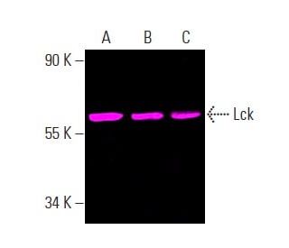 Lck (3A5): sc-433. Fluorescent western blot analysis of Lck expression in CCRF-CEM (A), Jurkat (B) and SUP-T1 (C) whole ce 