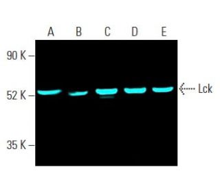 Lck (3A5): sc-433. Fluorescent western blot analysis of Lck expression in MOLT-4 (A), ALL-SIL (B), CCRF-CEM (C), Jurkat (D 