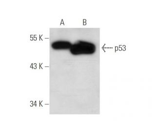 p53 (X77): sc-56186. Western blot analysis of p53 expression in... 