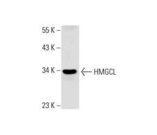 mouse liver extract: sc-2256. Western blot analysis of HMGCL expression... 