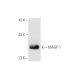 mouse ovary extract: sc-2404. Western blot analysis of MAGP-1 expression...