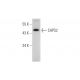 mouse testis extract: sc-2405. Western blot analysis of CAPS2 expression... 