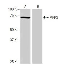 MPP3 Antibody (PZ-2D21) - Western Blotting - Image 65003