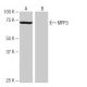 MPP3 Antibody (PZ-2D21) - Western Blotting - Image 65003