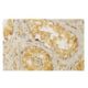 MRCKβ Antibody (Y-2D13) - Immunohistochemistry - Image 65005