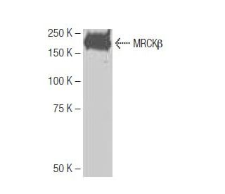 MRCK&beta; Antibody (Y-2D13) - Western Blotting - Image 65006 