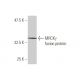 MRCKγ Antibody (2C3) - Western Blotting - Image 350227
