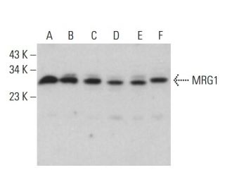 MRG1 Antibody (JA22) - Western Blotting - Image 383982SAM Transcription Activation: SAM system utilizing dCas9-VP64, MS2-P65-HSF1, and sgRNA for precise gene transcription activation.