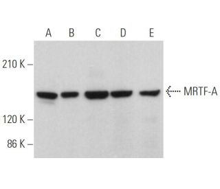 MRTF-A/MKL1 Antibody (G-7) - Western Blotting - Image 361699