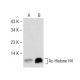Western blot analysis of Histone H4 acetylation in untreated (A) and MS-275 (sc-279455) treated (B) MCF7 whole cell lysate