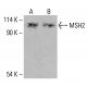 UBN-1(D-8)抗体:sc -515340。通过 Western blot 分析未处理的 HeLa(A)、经化学处理的 HeLa(B)、未处理的 K-562(C)、经化学处理的 K-562(D)和 HCT-116(E)完整细胞裂解物中的 UBN-1 表达。β-肌动蛋白(C4):sc-47778用作加载对照。使用的检测试剂:m-IgG Fc BP-HRP: sc-525409。 MSH2 Antibody (D-9) - Western Blotting - Image 415983