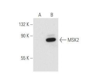 MSK2 Antibody (2934C1a) - Western Blotting - Image 56687 