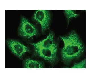 Msx-2 Antibody (F-6) - Immunofluorescence - Image 149270 