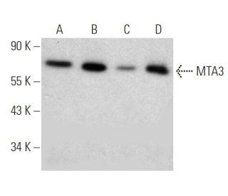 MTA3 Antibody (428C2a) - Western Blotting - Image 368187 