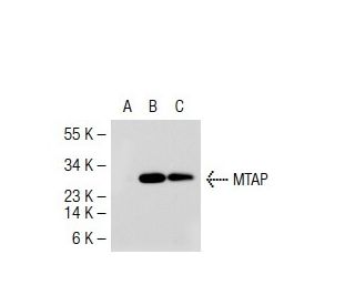 MTAP Antibody (42-T) - Western Blotting - Image 37345The Double Nickase Plasmid features a U6 promoter for sgRNA expression, a 20 nt targeting sequence, and a gRNA scaffold to guide Cas9n. It includes a CBh promoter for Cas9n (D10A) and puromycin resistance, GFP for transfection verification, and nuclear localization signals (NLS). The 2A peptide allows co-expression of Cas9n and Puro from a single promoter, enabling precise genome editing with reduced off-target effects.