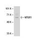 MTGR1 Antibody (CBF5I134) - Western Blotting - Image 30051 