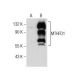 MTHFD1/1L Antibody (D-9) - Western Blotting - Image 158380 